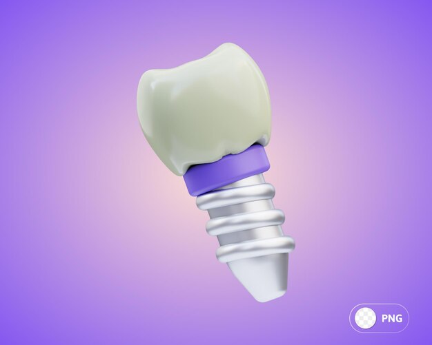 Ilustracja 3D implantów dentystycznych