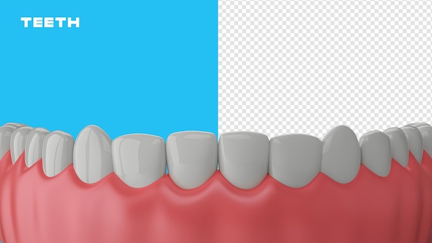 PSD inferior teeth