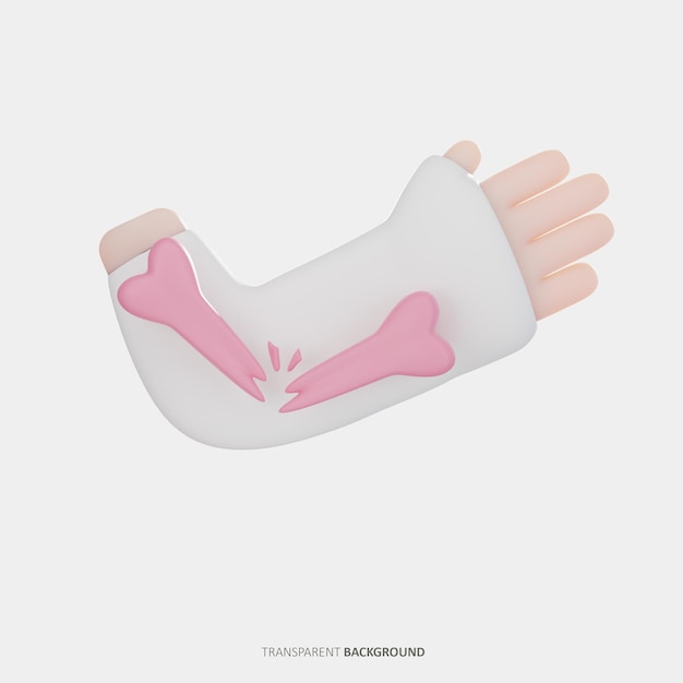 Injured hand and broken bones 3d illustration