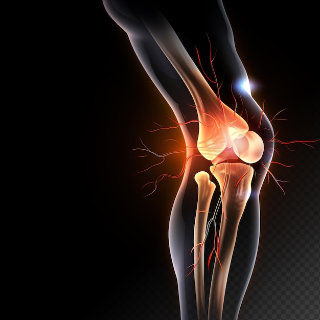 Knee joint pain in the bones and fasciitis