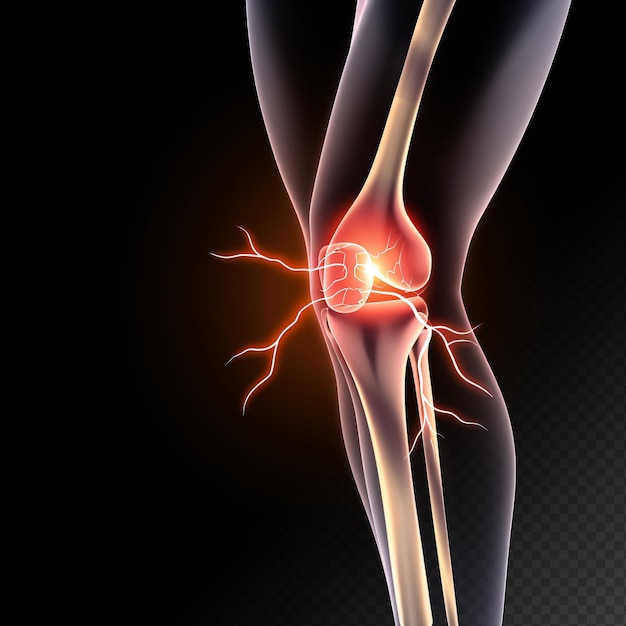 knee joint pain in the bones and fasciitis