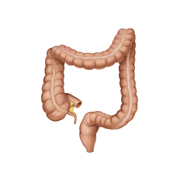 PSD large intestine