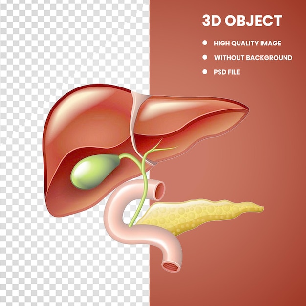 PSD leaver con pancreas