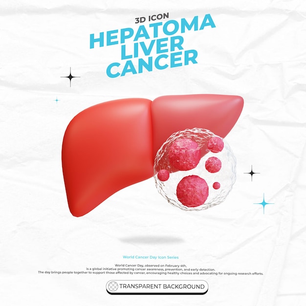 PSD liver cancer hepatoma hepatocellular carcinoma causes and treatment 3d illustration icon