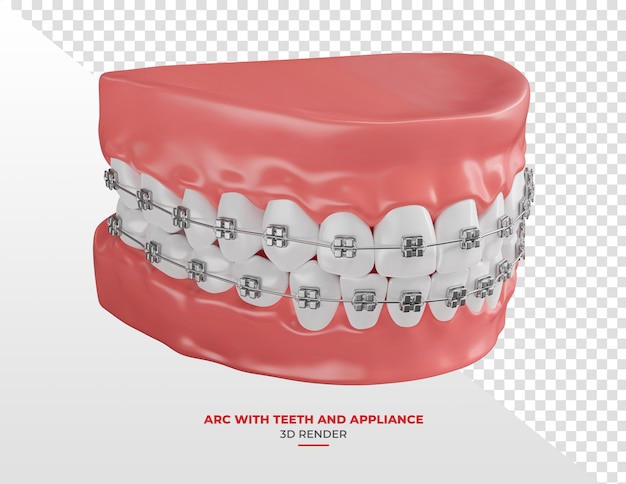 Łuk dentystyczny z białymi zębami i aparaturą ortodontyczną w renderowaniu 3D z przezroczystym tłem