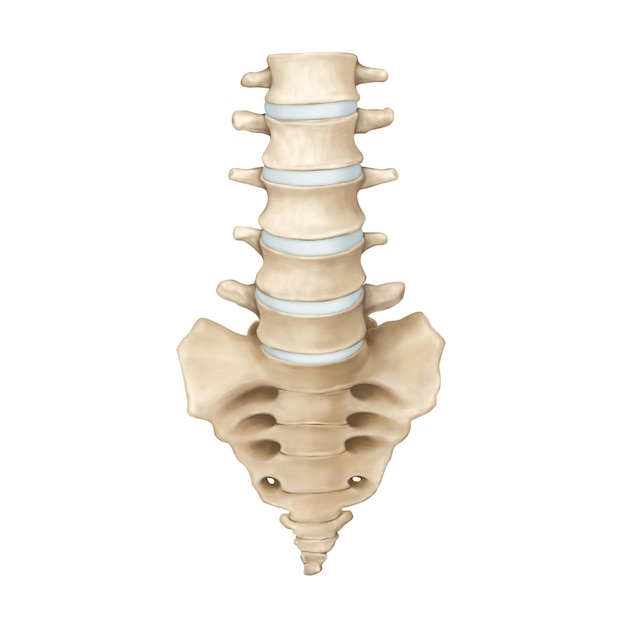 PSD lumbar spine