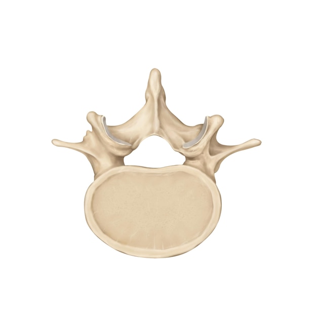 PSD lumbar spine