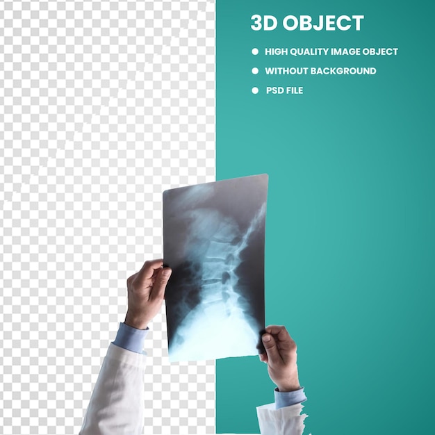 PSD medicine radiology