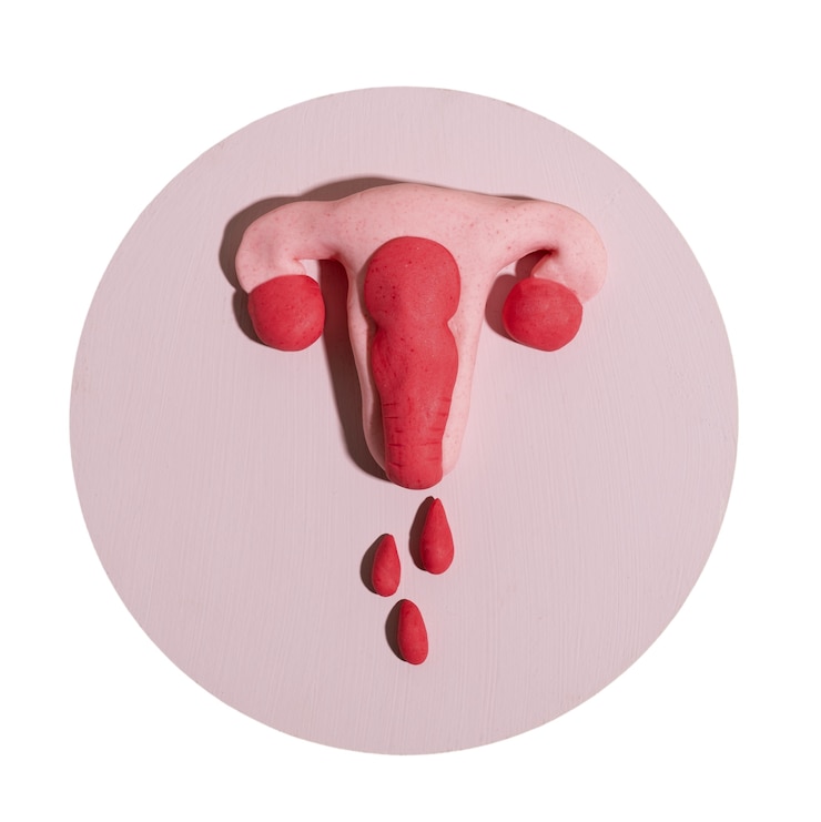 PSD ovaries and uterus shape isolated