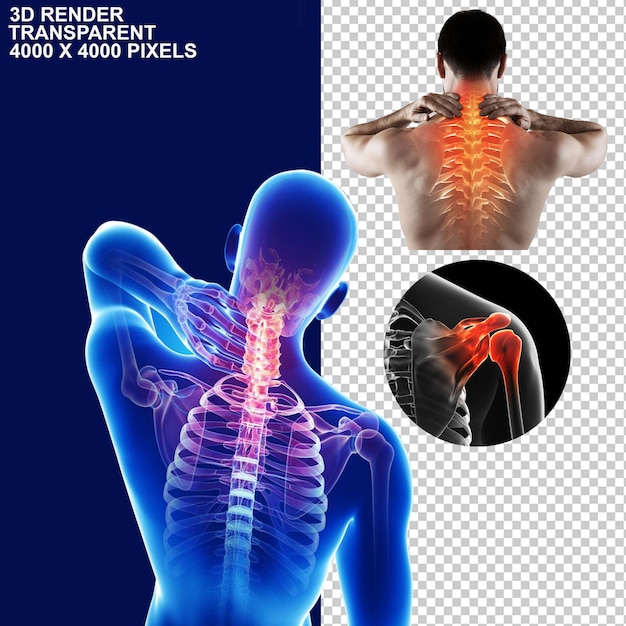 PSD dolore alle articolazioni dolore alla schiena dolore alle articolazioni dolore al collo dolore al ginocchio dolore alla parte superiore della schiena dorsale inferiore skeleton cerebrale