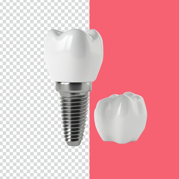 Psd 3d Renderuje Realistyczne Implanty Dentystyczne Na Izolowanym Przezroczystym Tle