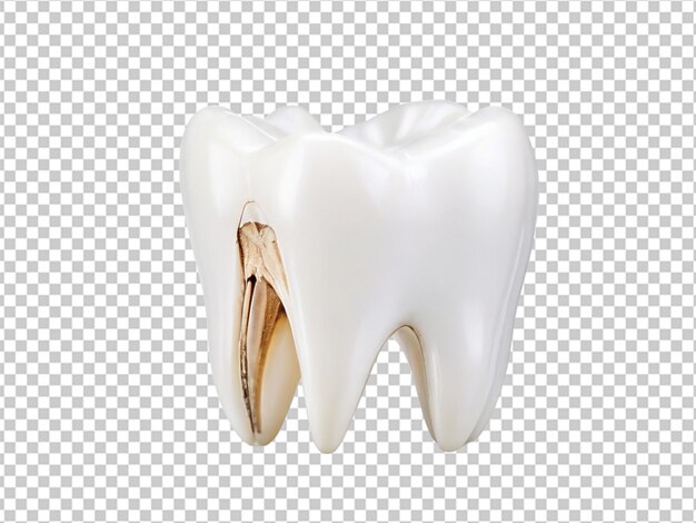 PSD psd di un dente