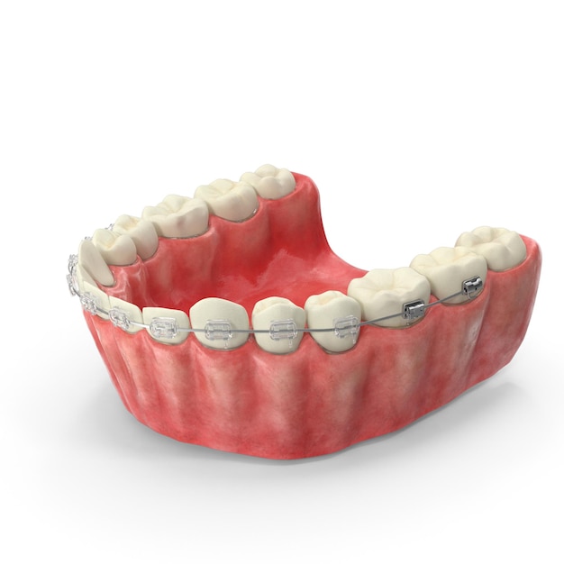 Реалистичная 3D человеческая нижняя челюсть с прозрачными зубными брекетами PSD файлы подробные ортодонтические и медицинские