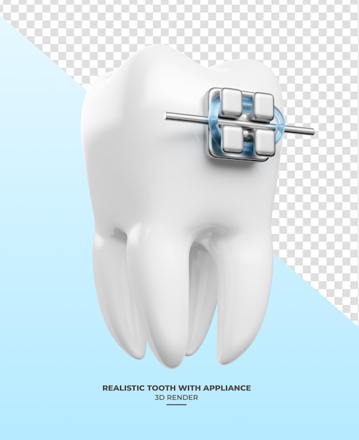 透明な背景の3dレンダーで歯科のブラケットを備えた現実的な歯