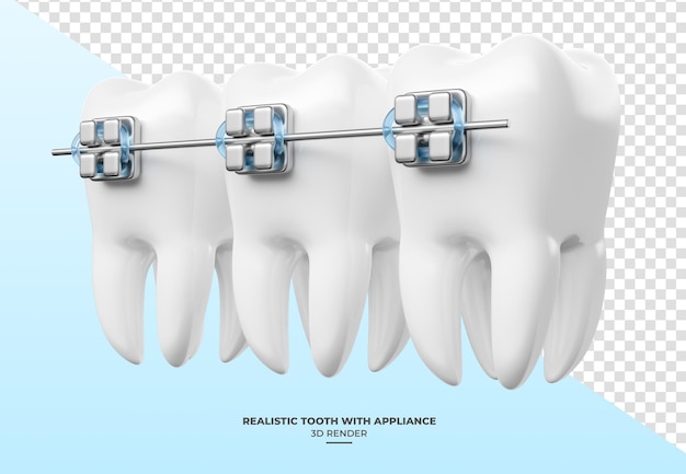 PSD realistyczny ząb z aparatami dentystycznymi w renderowaniu 3d z przezroczystym tłem