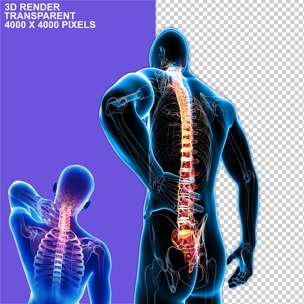 Skelton Muscles Bones Aches Back ache joint pain Knee Theraphy Bone Replacement Exercise
