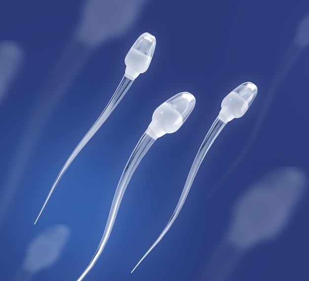 PSD sperm spin motion