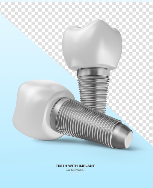 PSD tand met implantaten in 3d rendering met transparante achtergrond