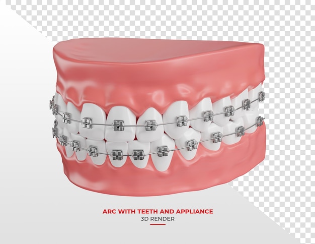 Tandboog met witte tanden en beugels in 3D-weergave met transparante achtergrond