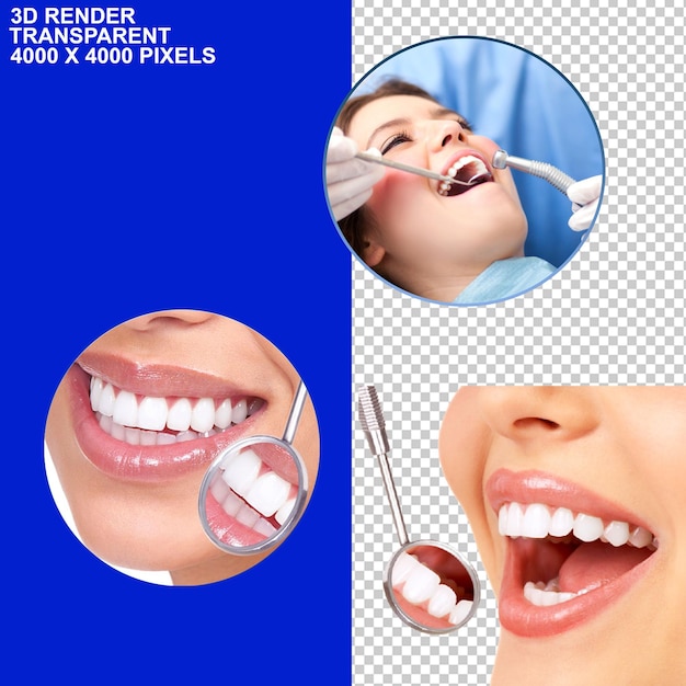 Tandenbehandeling Tandenbeugels Tandenimplantaten Tandenobservatie Tandencontrole Tandpijn Tandarts