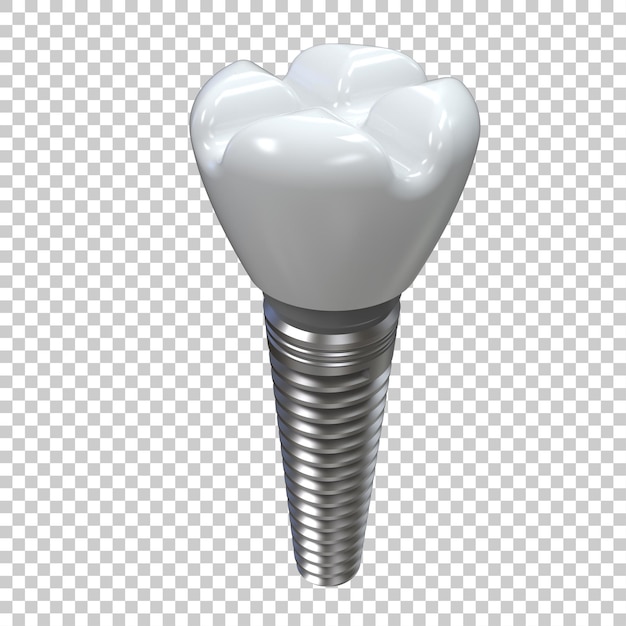 PSD tandimplantat geïsoleerd op een doorzichtige achtergrond 3d-weergave illustratie