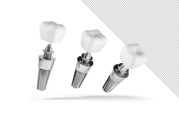 Three dental implant mockup