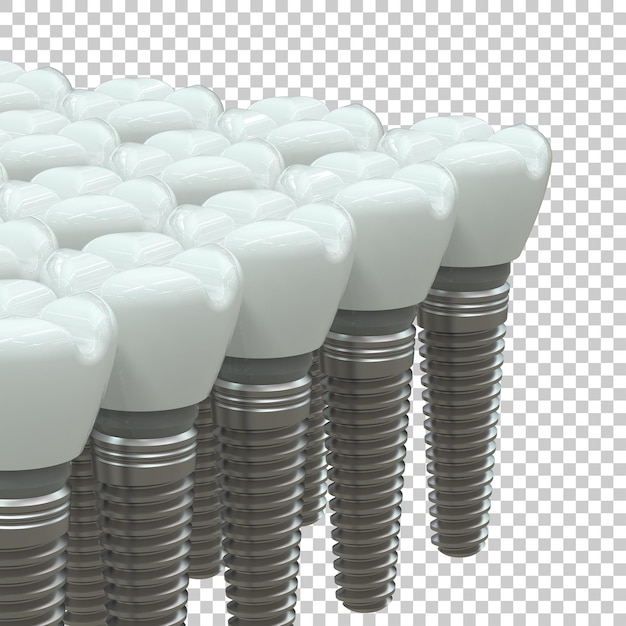 PSD tooth implant isolated on transparent background 3d rendering illustration