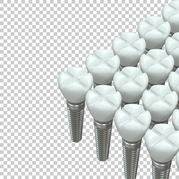 Impianto del dente su sfondo trasparente 3d rendering illustrazione