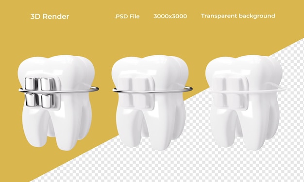 PSD dente con apparecchi ortodontici isolati su sfondo trasparente rendering 3d