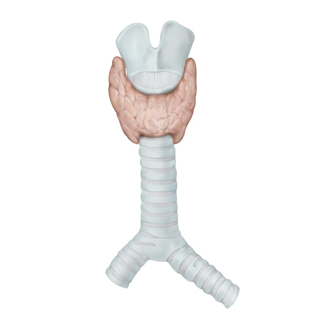 PSD trachea