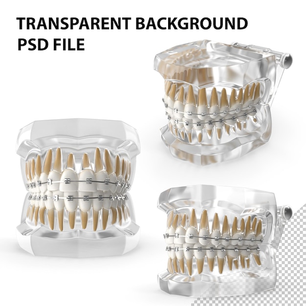 PSD transparent dental typodont teeth model with braces png