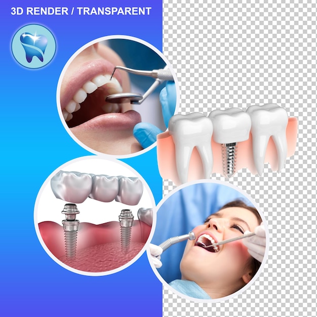 Zmień swój uśmiech Najnowsze rozwiązania w dziedzinie aparatów ortodontycznych, implantów i specjalistycznej opieki dentystycznej dla zdrowych zębów
