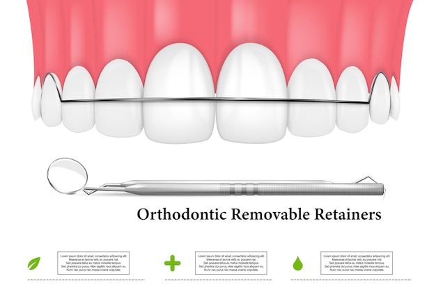 3d render of jaw with orthodontic removable retainer over whte background