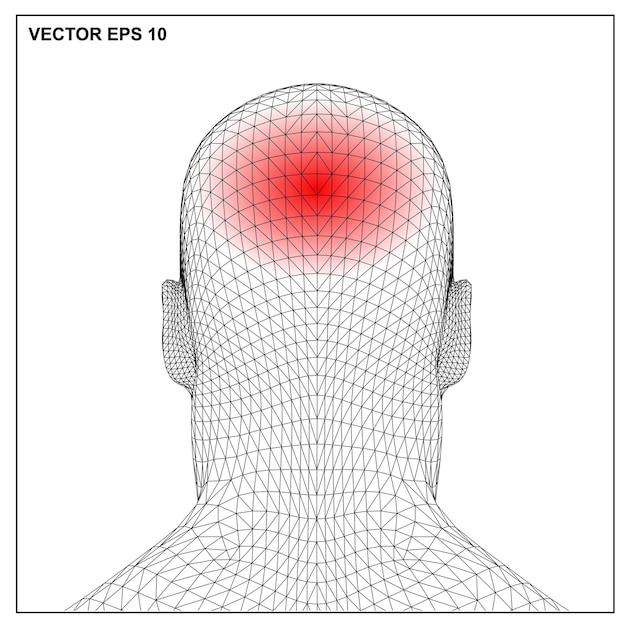 Vector 3d render medical illustration showing inflamed painful