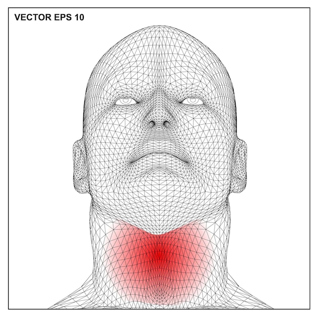 Vector 3d render medische illustratie die een ontstoken pijnlijke