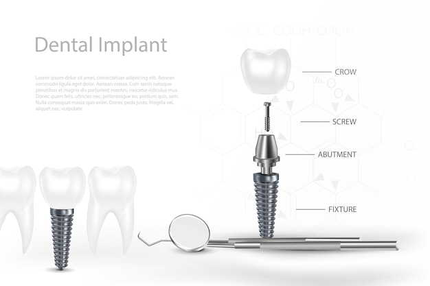 3D Tandheelkundige Implantaten Chirurgie Concept met Tool