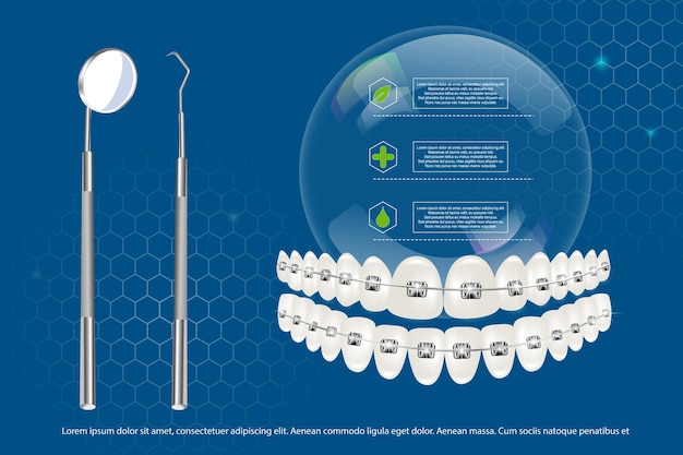 Vettore illustrazione vettoriale 3d denti realistici con parentesi graffe della mascella superiore e inferiore sullo sfondo di infografiche e strumenti allineamento del morso dei denti dentizione con parentesi graffe apparecchi dentali