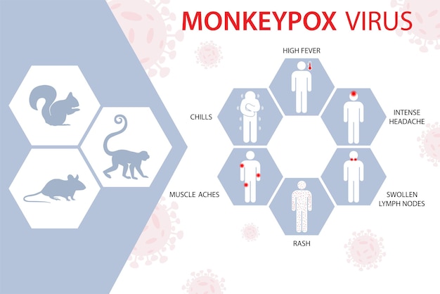 ベクトル サル痘の症状と広がりを知らせ、警告するサル痘ウイルスのバナー
