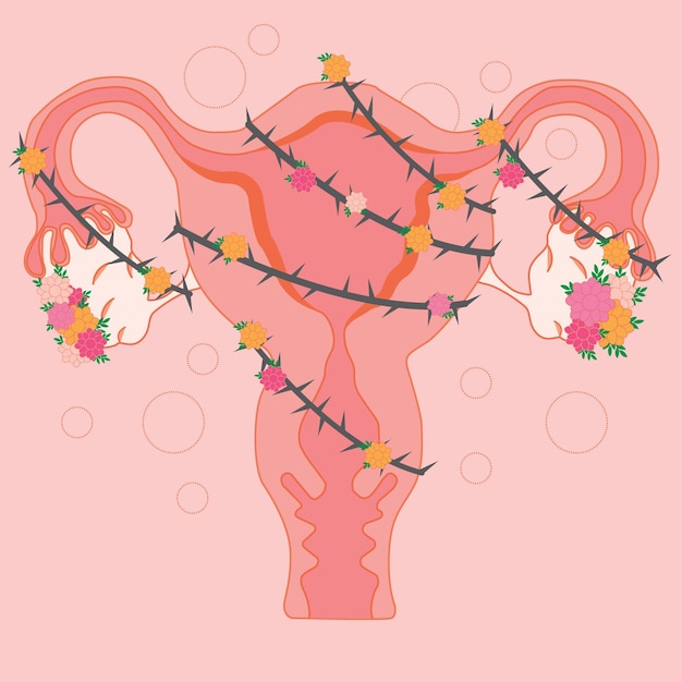 벡터 꽃과 여성의 자궁이라는 단어가 있는 자궁의 분홍색 삽화.
