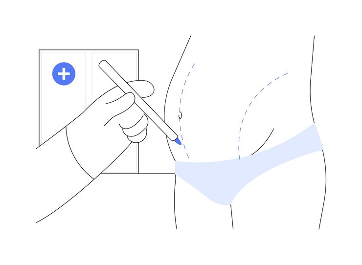 Vector abdominoplasty abstract concept vector illustration