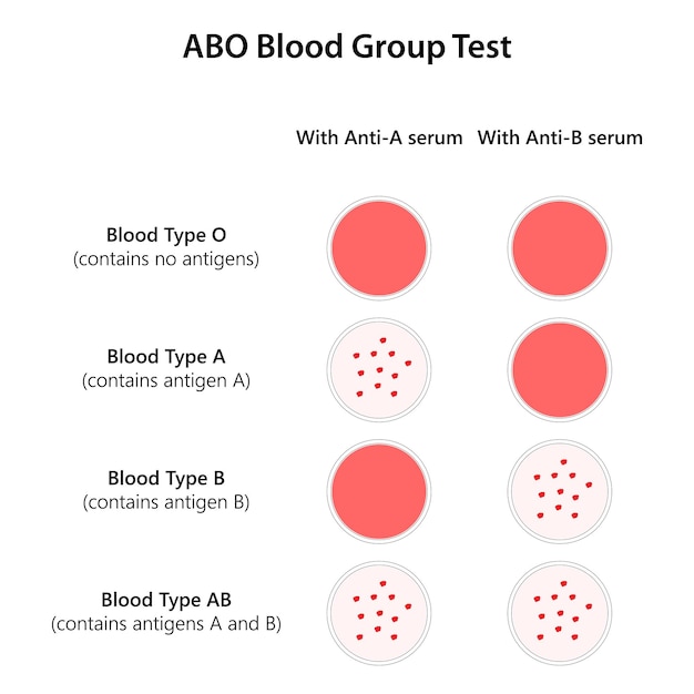 Vector abo blood group test