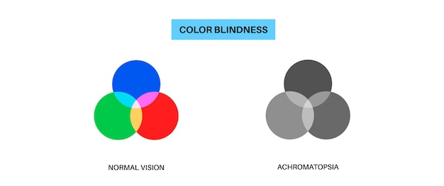 Vettore achromatopsia deficienza visiva
