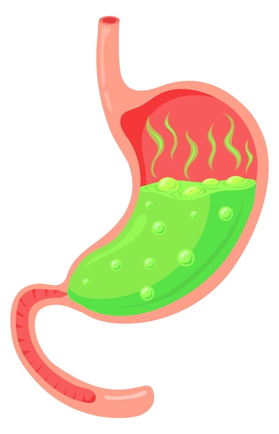 Acid stomach Reflux symptome Digestive pain illustration
