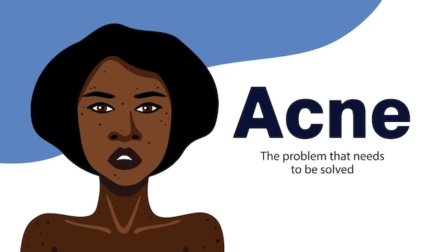 Vector acne banner with young african american woman minimalistic illustration