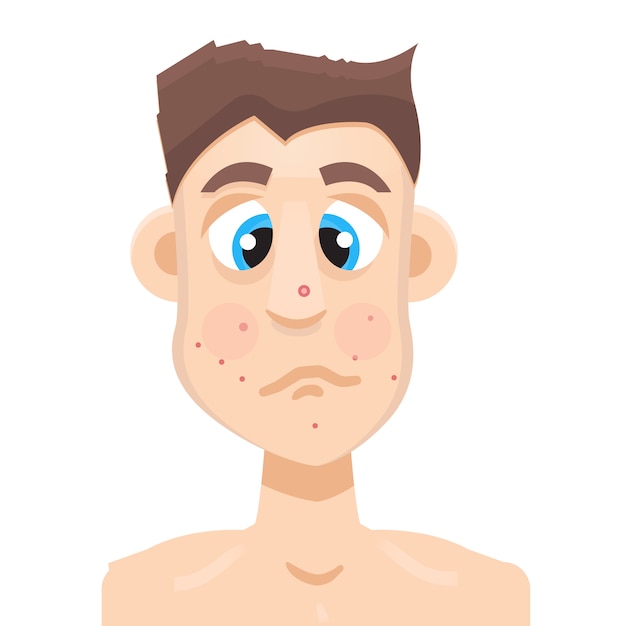 Vector acne man