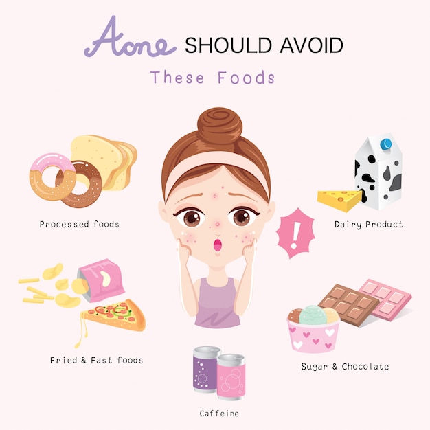 Vector acne should avoid these foods