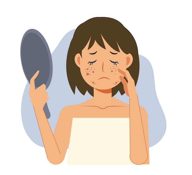 Acne skin problems ConceptWoman holding mirror is getting sad due to acne on her facialFlat vecor cartoon character illustration