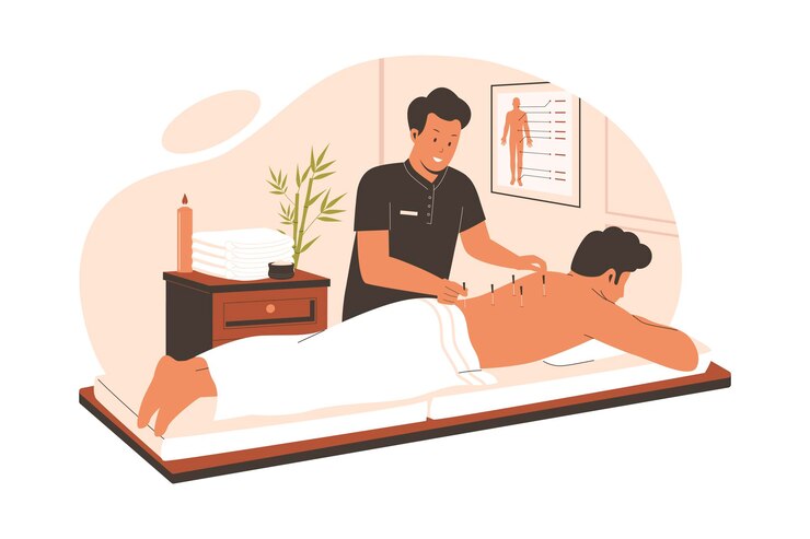 Vector acupunctuurbehandelingsconcept
