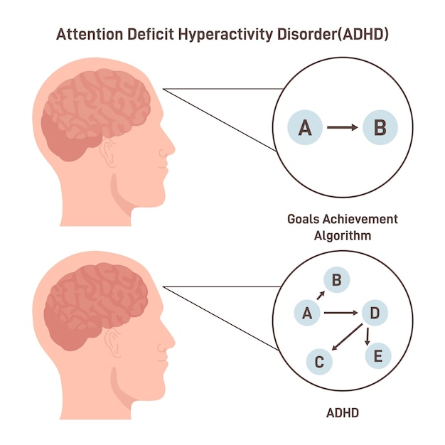 Vector adhd brain concept attention deficit hyperactivity disorder way