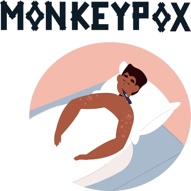 African man lying in bed with monkeypox